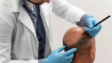 FUE, DHI & Robotic: New Hair Transplant Techniques That Make Results Look Amazingly Natural
