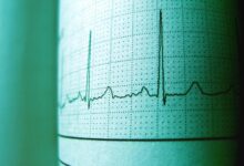 conversion tracker for pulse beacon