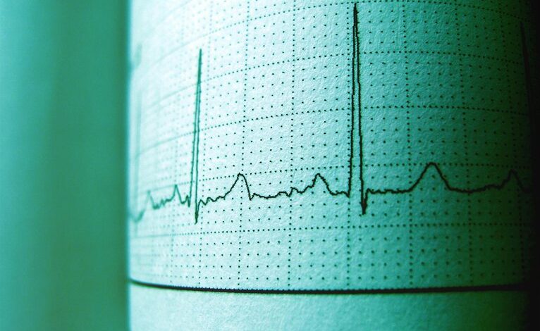 market builder horizon pulse