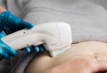 Discover the Transformative Benefits of HIFU Treatment for Youthful, Tightened Skin