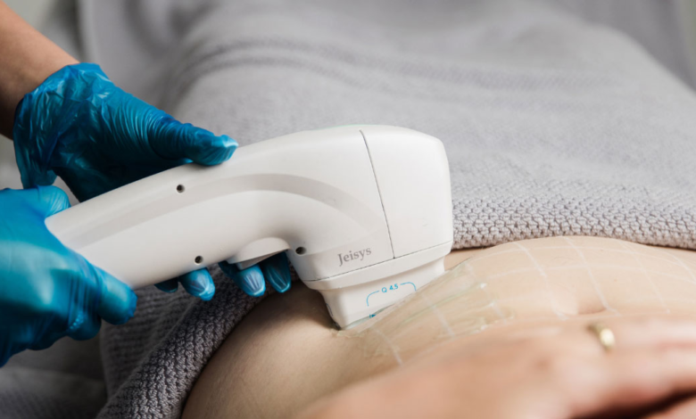 Discover the Transformative Benefits of HIFU Treatment for Youthful, Tightened Skin